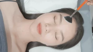 Công nghệ điều trị mụn hiệu quả là gì? Tổng hợp các công nghệ điều trị mụn tiên tiến nhất hiện nay