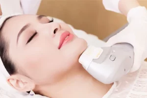 Công nghệ HIFU nâng cơ là gì? Hiệu quả, quy trình và những điều cần biết