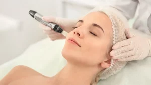 Công nghệ điều trị mụn hiệu quả là gì? Top các công nghệ điều trị mụn tiên tiến và đáng tin cậy nhất hiện nay
