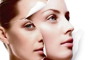 Công nghệ trẻ hóa da là gì? Các công nghệ trẻ hóa da hiện đại nhất hiện nay