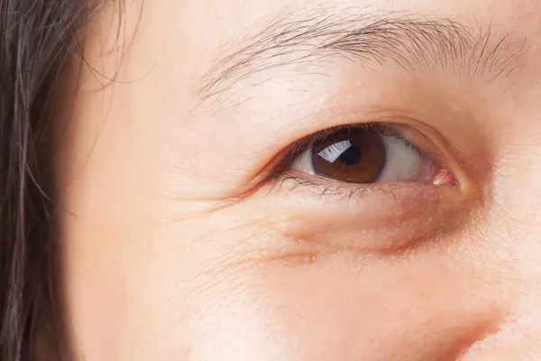 Kinh Nghiệm Thực Tế và Lưu Ý Khi Lựa Chọn Công Nghệ