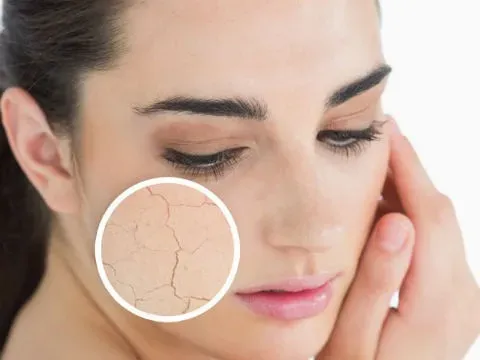 Lưu Ý Quan Trọng Khi Chăm Sóc Da Khô Bằng Công Nghệ