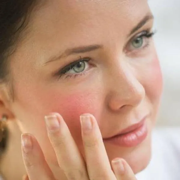 Những lưu ý "vàng" khi điều trị da nhạy cảm bằng công nghệ cao