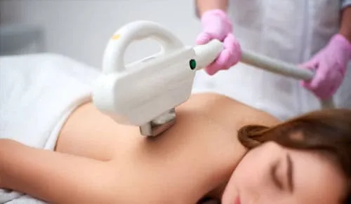 Chi phí điều trị mụn lưng bằng công nghệ cao là bao nhiêu?