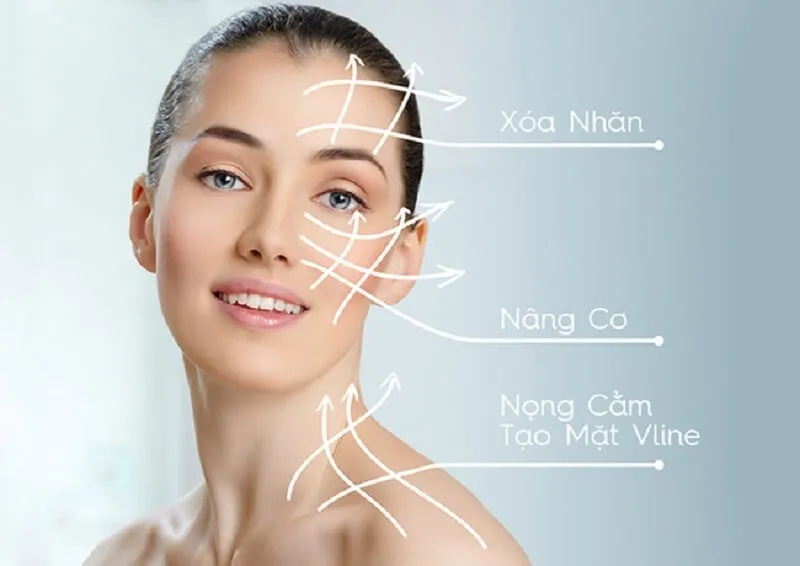 Chi phí cho một liệu trình HIFU nâng cơ là bao nhiêu?