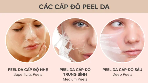 Chăm sóc da sau peel: "Chìa khóa" để làn da đẹp và an toàn