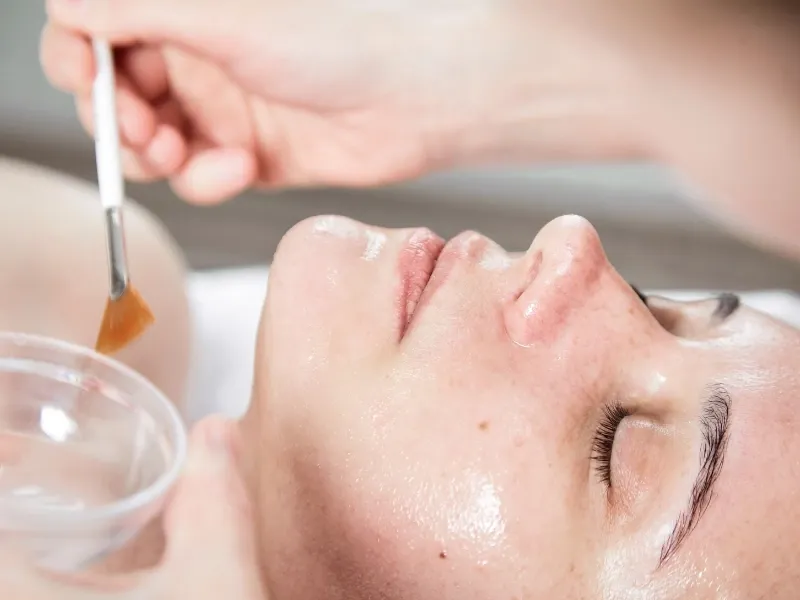 Peel da là gì? Tại sao peel da lại là "chìa khóa" cho làn da mới?