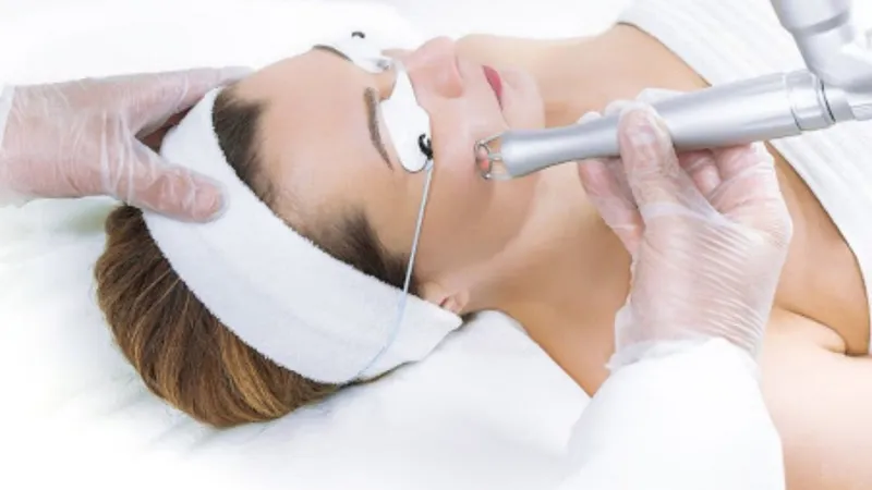 Quy trình điều trị nám bằng Laser Toning diễn ra như thế nào?