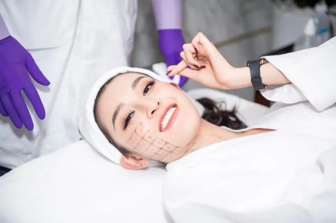 Công nghệ Thermage là gì? "Chìa khóa" cho làn da căng bóng không tuổi