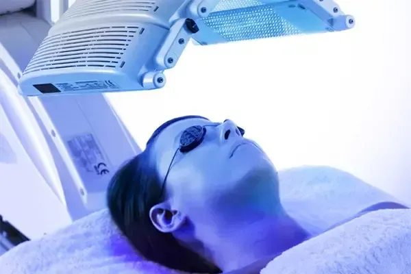 Tại sao ánh sáng xanh lại có thể "tiêu diệt" mụn trứng cá?