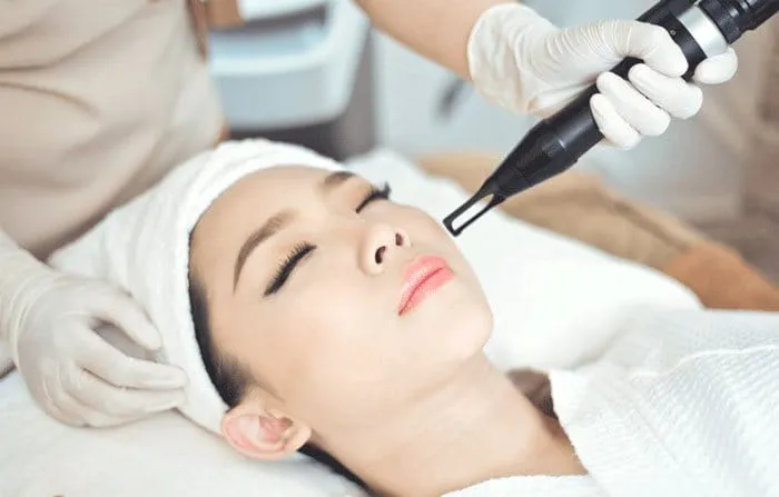 Nám da là gì và tại sao cần điều trị nám bằng laser?