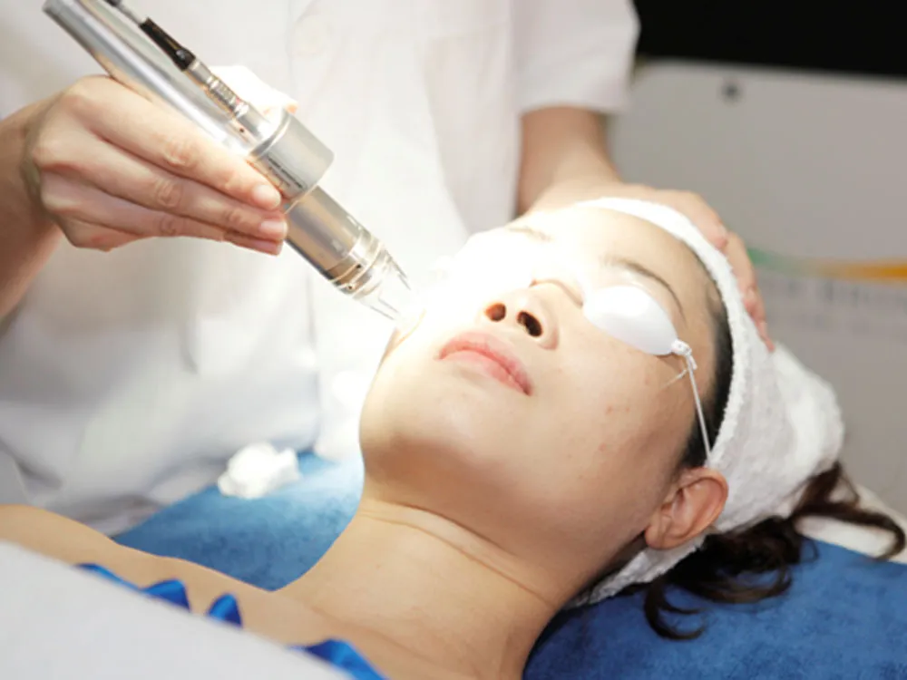 Điều trị sẹo rỗ bằng Laser có hiệu quả vĩnh viễn không?