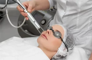 Công nghệ điều trị tăng sắc tố da nào hiệu quả và an toàn nhất hiện nay?