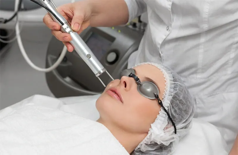 Các công nghệ "vượt trội" trong điều trị tăng sắc tố da